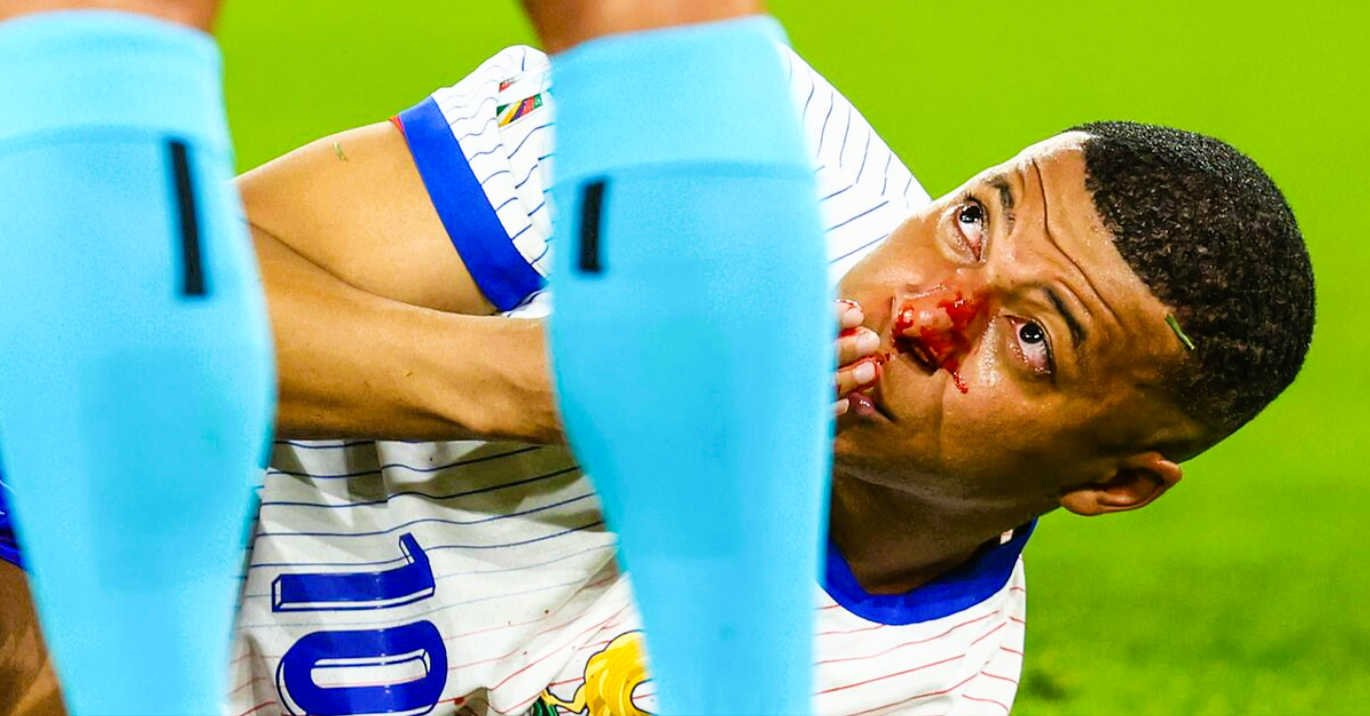 Operation! Mbappé fällt gegen Holland aus - Frankreich geschockt!